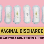 pink vaginal discharge, Vaginal discharge that smells like vinegar, what does vaginal discharge taste like