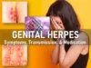 genital herpes symptoms women men, genital herpes treatment medication, genital herpes pictures hsv2