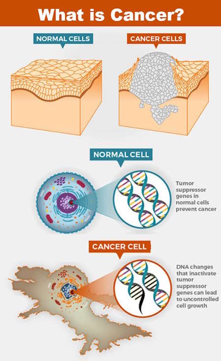 what is cancer