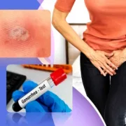 gonorrhea symptoms male female gonorrhea treatment oral rectal mouth tongue gonorrhea medication discharge