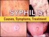 syphilis symptoms early stage, syphilis rash face legs thigh nasal pictures, syphilis treatment