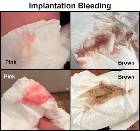 Implantation Bleeding Pictures, colors, Brown Implantation Bleeding pics