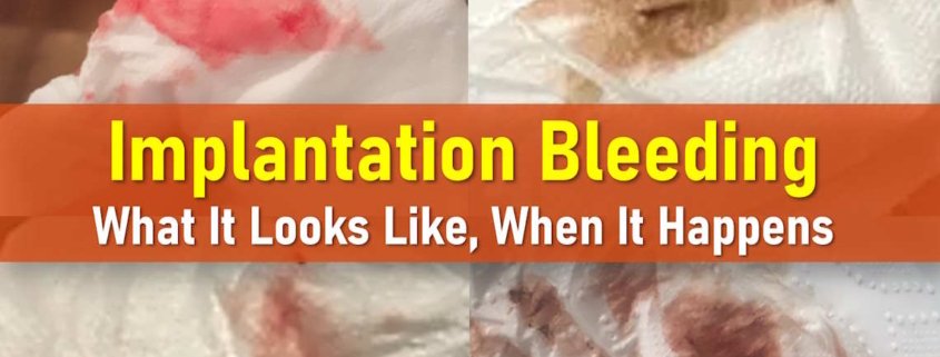 implantation bleeding pictures, when it happens, what it looks like