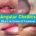 angular cheilitis overnight cure, medication, angular cheilitis vs cold sore pictures, sores corner of mouth